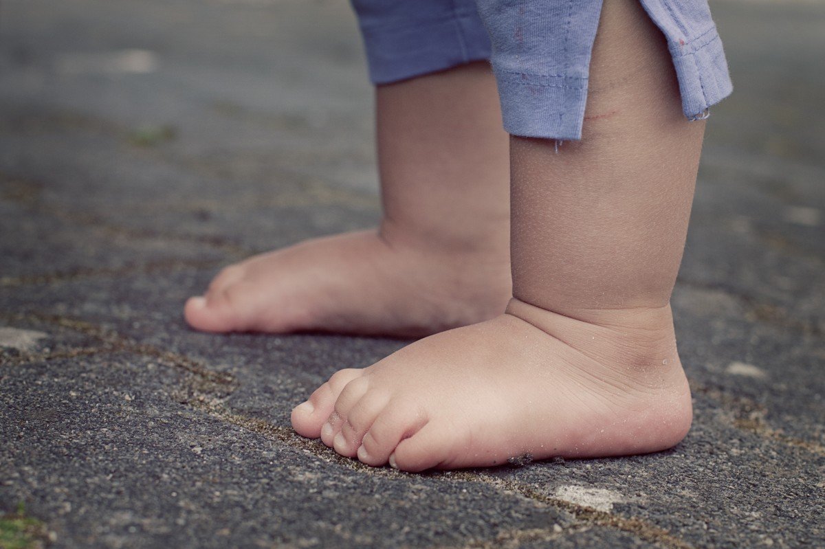 A mi peque le sudan los pies ¿es normal?